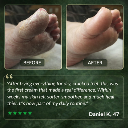 NAVERO TEA TREE OIL FOOT CREAM